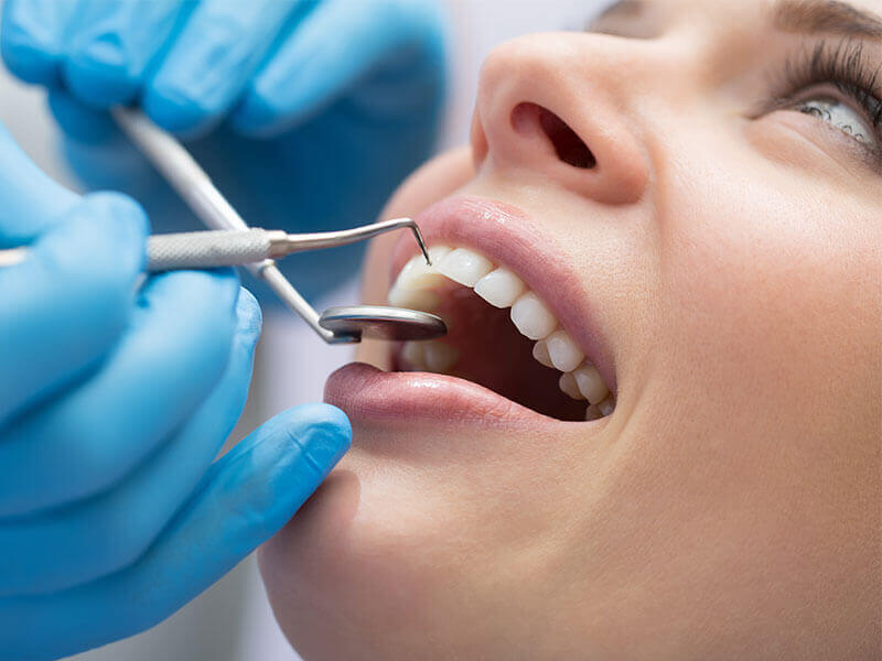 Extração de siso Tatuapé