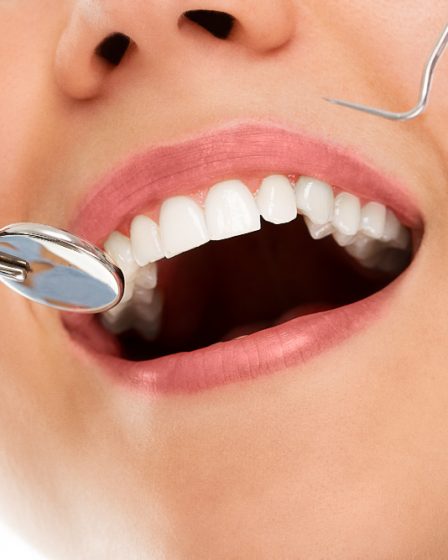 Seu sorriso não pode esperar: encontre o melhor dentista particular na Vila Gomes Cardim