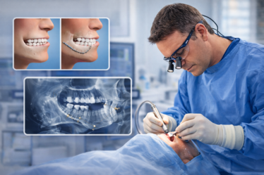 BLOG MAXFACIAL CIRURGIA ORTOGNATICA