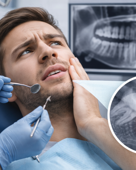 Quando um Cisto Dentário Precisa de Cirurgia