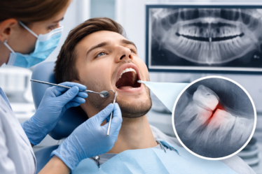 Como Saber se o Dente Está Incluso