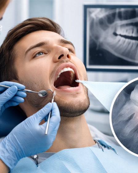 Como Saber se o Dente Está Incluso