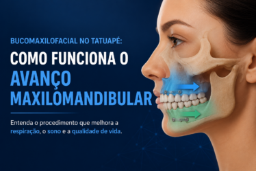 Bucomaxilofacial no Tatuapé: Como Funciona o Avanço Maxilomandibular