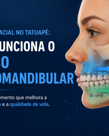Bucomaxilofacial no Tatuapé: Como Funciona o Avanço Maxilomandibular