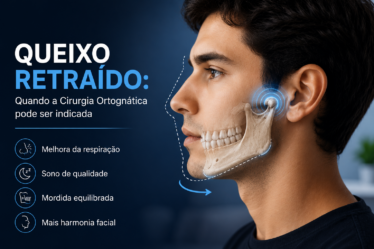 MaxFacial