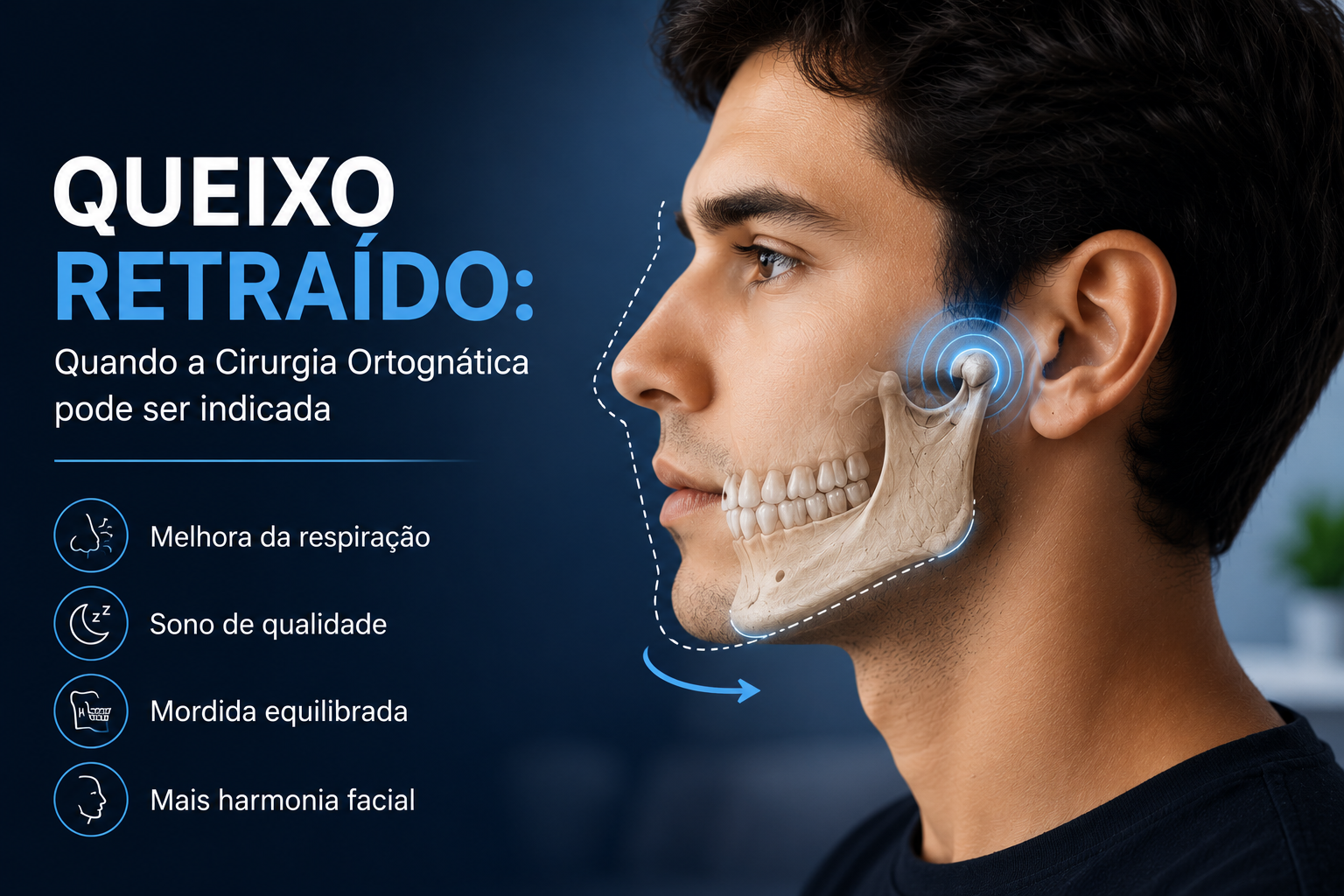 MaxFacial
